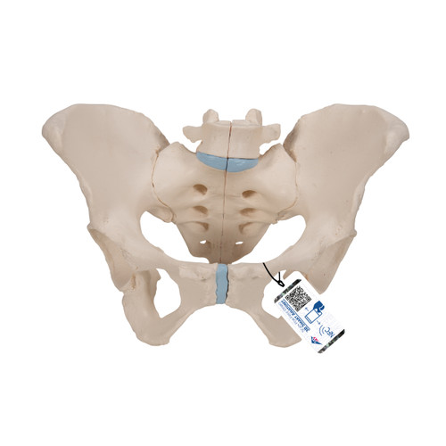 This life size three part model represents an original cast of a bony female pelvis and shows all the details of the following anatomical structures: Two hip bones, the pubic symphysis, the sacrum and the coccyx, the fifth lumbar vertebra with intervertebral disc.  A midsagital section through the fifth lumbar vertebra, sacrum and coccyx, allow both halves of the pelvis to be disassembled revealing a part of the cauda equina in the vertebral canal. The left half of the fifth lumbar vertebral body is removable.