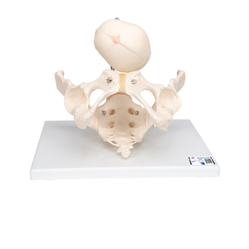 This childbirth model demonstrates the progress of the fetal head through the pelvis during birth. The childbirth demonstration pelvis simulator consists of a female pelvic skeleton with a movable symphysis, hip bone, sacrum, coccyx and 2 lumbar vertebrae articulated to accommodate passage of a fetal skull mounted on an omni positioning flexible gooseneck support. A realistic anatomical replica of the childbirth process. Childbirth pelvis delivered on baseboard.