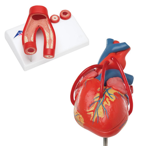 Heart: Highly detailed 2-part heart at a price you will love. The front heart wall is detachable to reveal the chambers and valves inside. Heart just slightly smaller than life-size with exquisite anatomical detail throughout