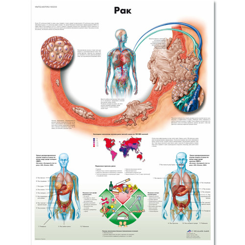 Cancer  Chart