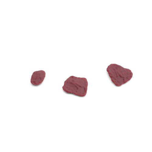 Placenta residual pieces 1 set