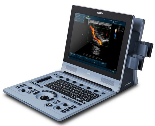 Powerful. Innovative.  The U60 empowers users with innovative technologies to help optimize daily workflows. As one of the most capable diagnostic ultrasound machines on the market, the Edan U60 supports comprehensive clinical applications and user-friendly operation.