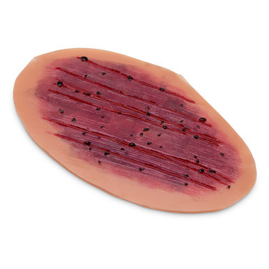 Nasco Healthcare Road Rash, Large 800-654