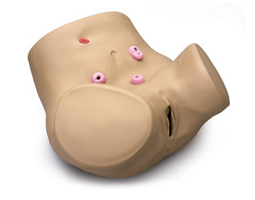 Nasco Healthcare Advanced Patient Care Female Ostomy S230.2.PK.L – a realistic female patient care simulator designed for advanced training in ostomy management and nursing procedures. Perfect for healthcare education and skill development.