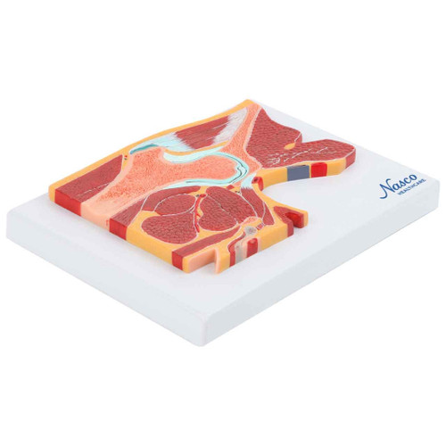 Hip Model, Midsection MG17227