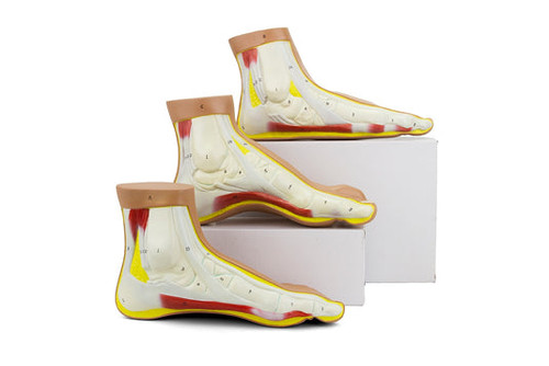 Normal and Abnormal Foot Models, Set of 3 MG22042U