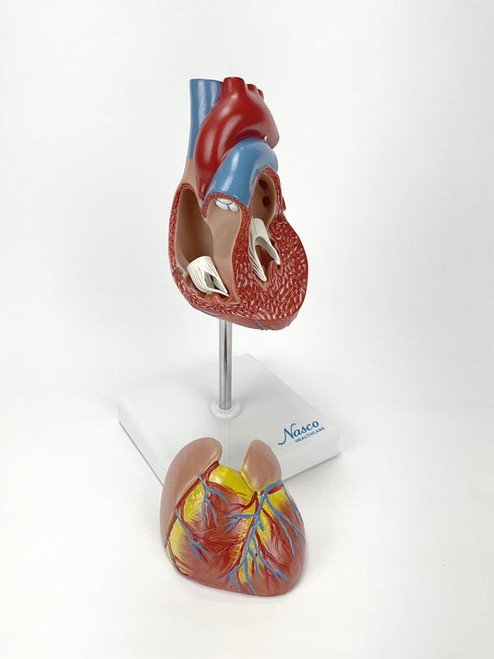 Classic Heart Model with Ventricular Hypertrophy MG22274U