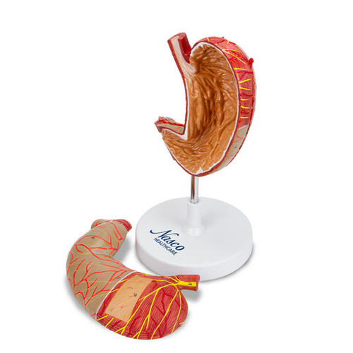 Stomach Model, Enlarged, 2 Parts MG23160U