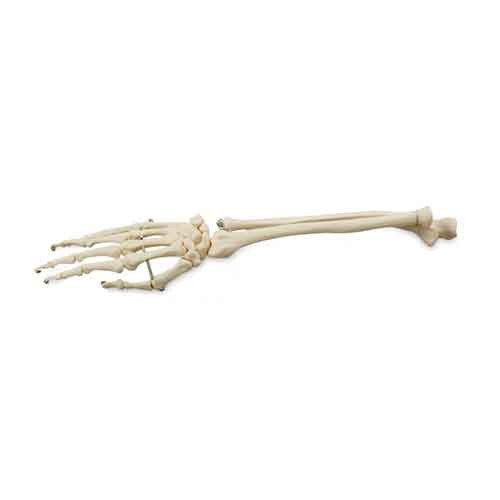 Hand with Ulna and Radius Model, Wire Mounted MG22953U