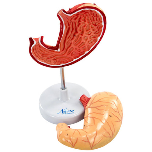Stomach Model, 2 Parts MG23164U