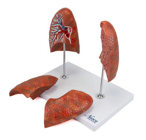 Lung Model, 4 Parts MG29786U