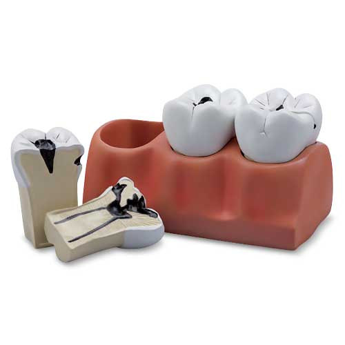 Dental Morphology Model, 4X Enlarged, 7 Parts MG29837U