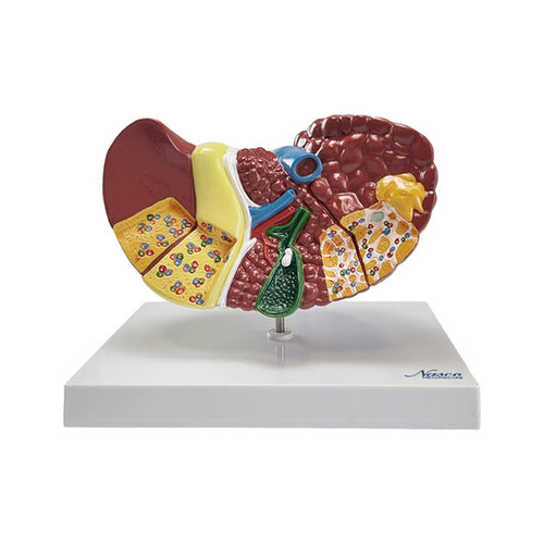 Liver Section with Pathologies Model MG36908U