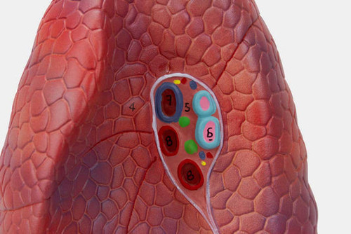 Lung Model, 2 Parts MG30887U