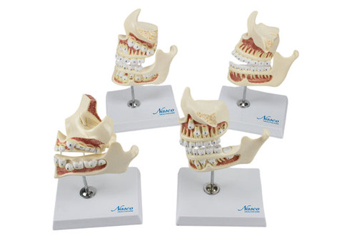 Development of Dentition Models Set, 4 Stages MG36200U