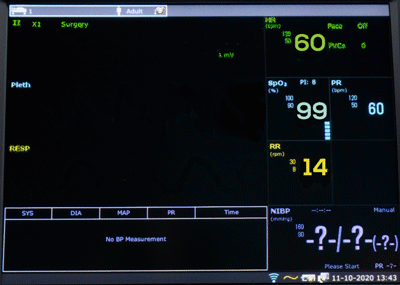 Edan Veterinary X Series Monitors with Touchscreen  