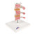 This osteoporosis model consists of 3 medially divided lumbar vertebrae with intervertebral discs. For anatomical comparison, the upper section shows healthy bone structure, the middle section osteoporotic bone structure and the lower section advanced osteoporotic bone structure with flattened plates, deformation and decreased bone mass. For detailed anatomical study the vertebrae can be removed from the stand. The osteoporosis model is a great high quality anatomical teachin
