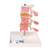 This osteoporosis model consists of 3 medially divided lumbar vertebrae with intervertebral discs. For anatomical comparison, the upper section shows healthy bone structure, the middle section osteoporotic bone structure and the lower section advanced osteoporotic bone structure with flattened plates, deformation and decreased bone mass. For detailed anatomical study the vertebrae can be removed from the stand. The osteoporosis model is a great high quality anatomical teachin