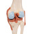 This high-quality deluxe functional knee joint model with ligaments shows the anatomy and possible physiological movements of the human knee joint in exceptional detail.  This model clearly demonstrates abductions, anteversion, retroversion, internal and external rotation. This knee joint model also clearly defines the ACL and PCL.  The color of the natural-cast bones of the knee joint is extremely realistic. The cartilage on the knee joint surfaces is marked blue. This model consists of portions of the femur, tibia and fibula, menisci and patella. The Functional Knee joint model is mounted on a base for easy display.