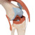 This high-quality deluxe functional knee joint model with ligaments shows the anatomy and possible physiological movements of the human knee joint in exceptional detail.  This model clearly demonstrates abductions, anteversion, retroversion, internal and external rotation. This knee joint model also clearly defines the ACL and PCL.  The color of the natural-cast bones of the knee joint is extremely realistic. The cartilage on the knee joint surfaces is marked blue. This model consists of portions of the femur, tibia and fibula, menisci and patella. The Functional Knee joint model is mounted on a base for easy display.