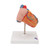 This unique heart model shows the long-term effects of increased heart activity due to high blood pressure. The muscular wall of the left heart ventricle is considerably thickened and the tip of the heart is visibly rounded off. Highly detailed 2-part heart at a price you will love. The front heart wall is detachable to reveal the chambers and valves inside. The heart is just slightly smaller than life-size with exquisite anatomical detail throughout. Heart on removable stand.