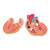 This unique heart model shows the long-term effects of increased heart activity due to high blood pressure. The muscular wall of the left heart ventricle is considerably thickened and the tip of the heart is visibly rounded off. Highly detailed 2-part heart at a price you will love. The front heart wall is detachable to reveal the chambers and valves inside. The heart is just slightly smaller than life-size with exquisite anatomical detail throughout. Heart on removable stand.