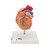 This unique heart model shows the long-term effects of increased heart activity due to high blood pressure. The muscular wall of the left heart ventricle is considerably thickened and the tip of the heart is visibly rounded off. Highly detailed 2-part heart at a price you will love. The front heart wall is detachable to reveal the chambers and valves inside. The heart is just slightly smaller than life-size with exquisite anatomical detail throughout. Heart on removable stand.
