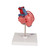 Highly detailed 2-part heart at a price you will love. The front heart wall is detachable to reveal the chambers and valves inside. Heart just slightly smaller than life-size with exquisite anatomical detail throughout. Heart includes venal bypasses to the right coronary artery, to the ramus interventricularis anterior, and also to the ramus circumflexus of the left coronary artery, which are shown in color. This heart model is a great aid explaining the treatment of coronary heart disease. Heart on removable stand.