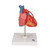 Highly detailed 2-part heart at a price you will love. The front heart wall is detachable to reveal the chambers and valves inside. Heart just slightly smaller than life-size with exquisite anatomical detail throughout. Heart includes venal bypasses to the right coronary artery, to the ramus interventricularis anterior, and also to the ramus circumflexus of the left coronary artery, which are shown in color. This heart model is a great aid explaining the treatment of coronary heart disease. Heart on removable stand.