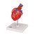 Highly detailed 2-part heart at a price you will love. The front heart wall is detachable to reveal the chambers and valves inside. Heart just slightly smaller than life-size with exquisite anatomical detail throughout. Heart includes venal bypasses to the right coronary artery, to the ramus interventricularis anterior, and also to the ramus circumflexus of the left coronary artery, which are shown in color. This heart model is a great aid explaining the treatment of coronary heart disease. Heart on removable stand.