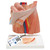 This natural-sized, graphic model shows the anatomical structures of a male groin with an indirect inguinal hernia, opened in layers. Two diagrammatic illustrations on the base allow for a comparison of direct and indirect hernia. A useful model to help inform patients before undergoing surgical interventions. Mounted on base.
