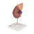 The front half of the kidney is removable to enable demonstration of cortex medulla and vessels for teaching about the human kidney. The renal pelvis of the kidney is also displayed. 20 important structures of the human kidney are included in the anatomy key. Kidney with adrenal gland model comes on stand.