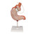 Human Stomach Model with Gastric Band, 2 part - 3B Smart Anatomy