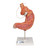 The model was developed based on our existing two-part stomach model to which was added an SAGB Quick Close® gastric band. A gastric band is inserted surgically to treat morbid obesity if conservative treatments are unsuccessful. This model is highly suitable as a tool for explaining the device to patients.