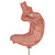 Human Stomach Model with Gastric Band, 2 part - 3B Smart Anatomy