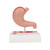 Human Stomach Section Model with Ulcers - 3B Smart Anatomy