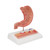 Human Stomach Section Model with Ulcers - 3B Smart Anatomy