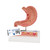Human Stomach Section Model with Ulcers - 3B Smart Anatomy