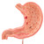 Human Stomach Section Model with Ulcers - 3B Smart Anatomy