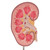 Kidney Stone Model - 3B Smart Anatomy