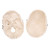 Our mini skull is a great three part anatomical model. The mini skull model precisely depicts the anatomical structures of the human skull in a manner that is true to detail and can be disassembled into skullcap, base of skull and mandible. This skull is a great addition to any classroom.

Every original 3B Scientific® Anatomy Model gives you direct access to its digital twin on your smartphone, tablet or desktop device.
