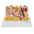 Skin Section with Pathology Model, 30X Enlarged MG21065U