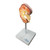 Kidney Stone (Nephrolites) Model MG21415