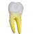 Lower Molar Tooth Model, 2 Parts MG29802U