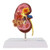 Kidney with Pathology Model, 2-1/2X Enlarged MG31019U