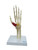 Carpel Tunnel Syndrome Model MG35507U