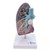 Lung with Pathology Model, 1.5X Enlarged MG30885U
