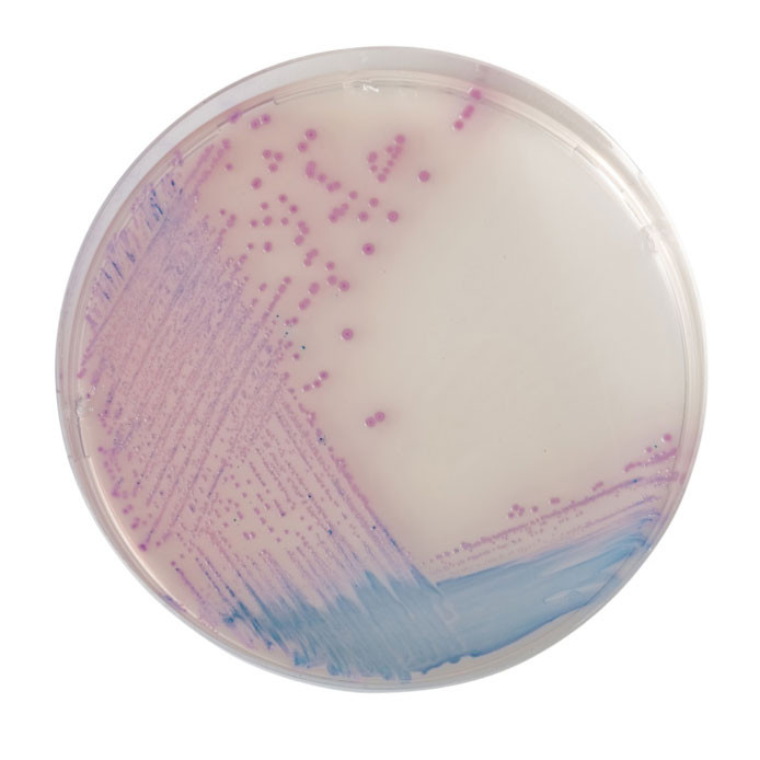 COLOREX Salmonella Prepared Plates (20pk) - Microbiology International
