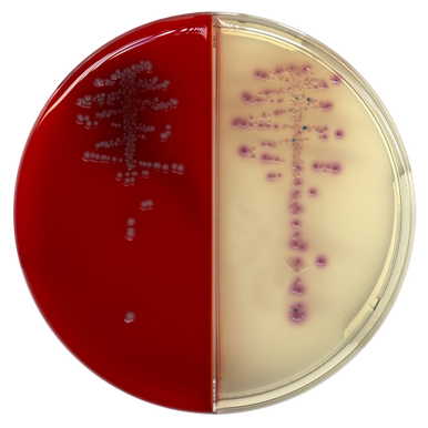 COLOREX Orientation/Blood CNA Agar Prepared Biplates (20 pk ...
