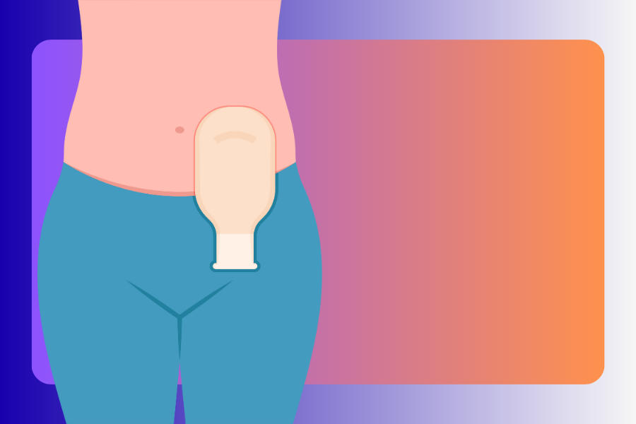 Product Guide: How to Choose Your Ostomy Supplies